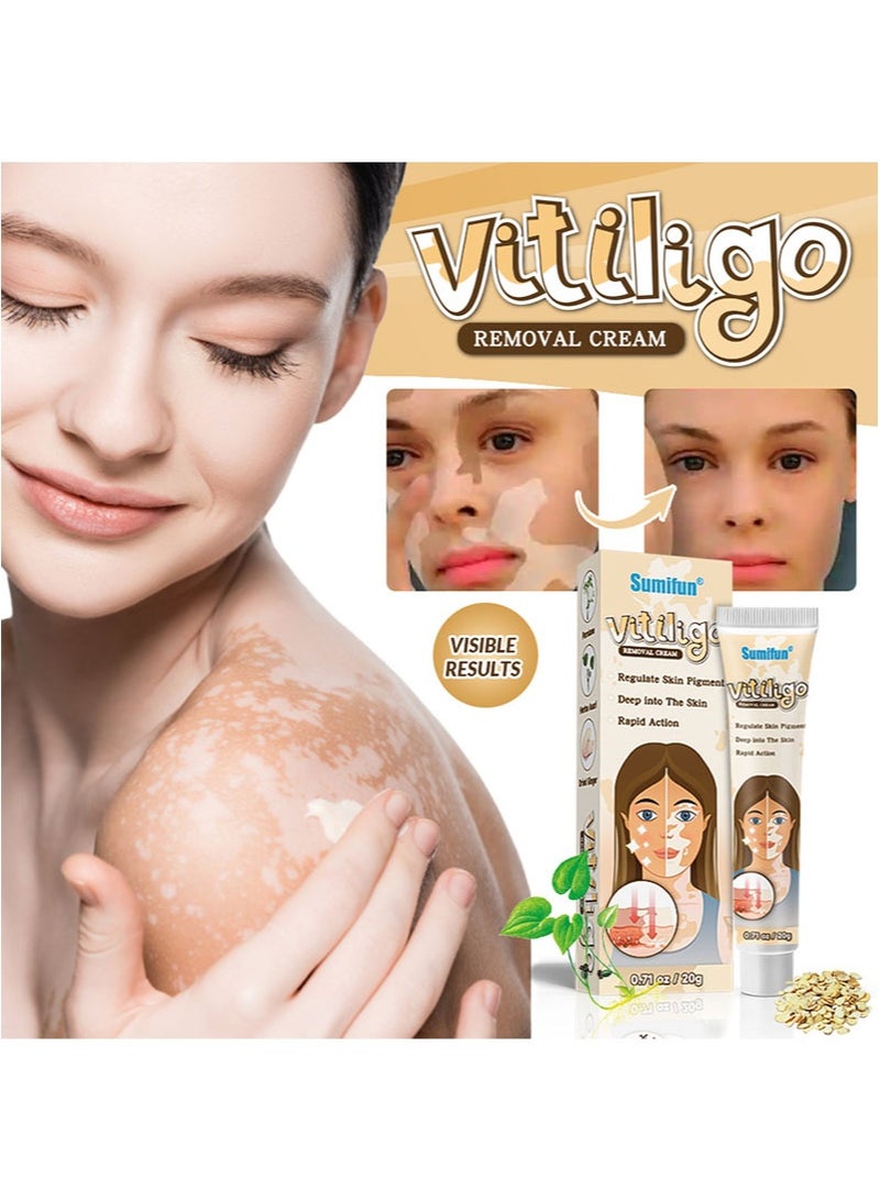 سوميفون كريم لإزالة البهاق 2 قطعة يحسن تصبغ الجلد ويقلل البقع البيضاء، تركيبة طبيعية، مناسب لجميع أنواع البشرة (20 جم + 20 جم) - Image 4